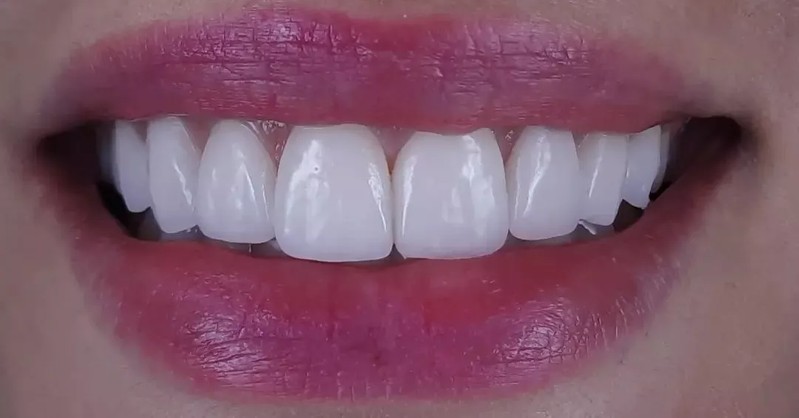 Cover Picture 2 Of Maalouf Dental Clinic